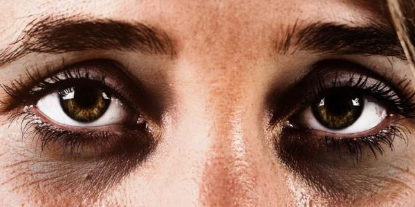 افضل كريم للهالات السوداء