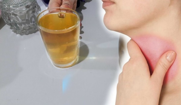 المشروب السحري لالتهاب الحلق