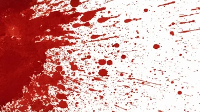 الدم في الحلم