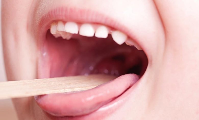 التخلص من التهاب الحلق بسرعة