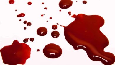 الدم في الحلم