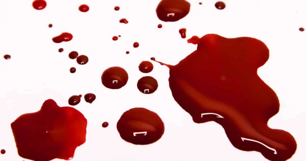 الدم في الحلم