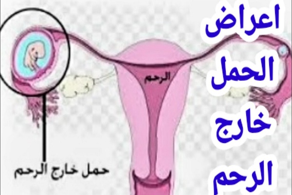 اعراض الحمل خارج الرحم
