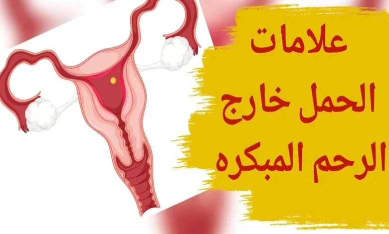 اعراض الحمل خارج الرحم