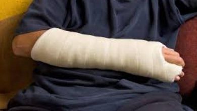 حكم المسح على الجبيرة