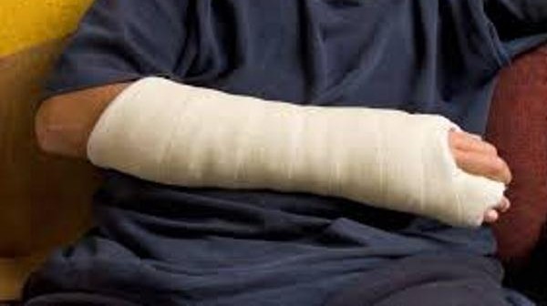 حكم المسح على الجبيرة