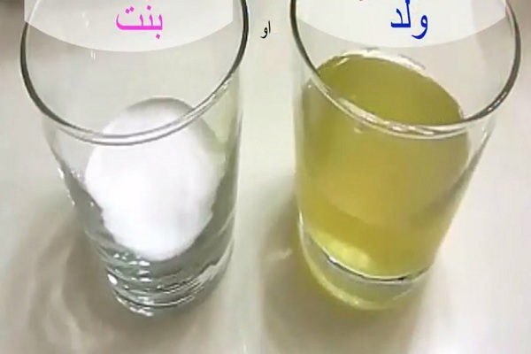 كيف اعرف اني حامل بولد