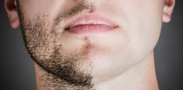 هل حلق اللحية حرام