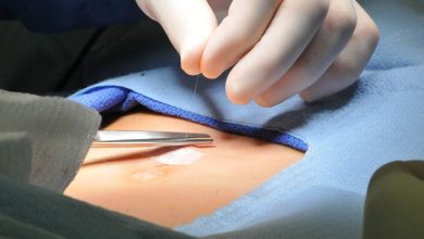 عملية الفتاق