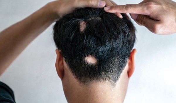 كيف أعرف أنها ثعلبة