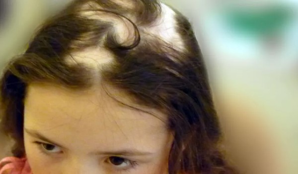 كيف أعرف أنها ثعلبة