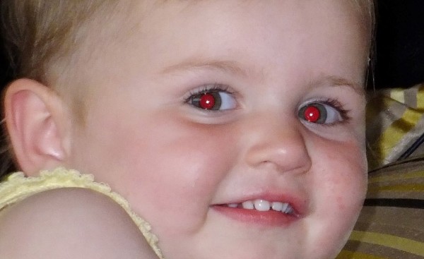 برنامج إزالة العين الحمراء من الصور